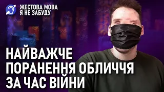 Я не забуду | Жестова мова | Найважче поранення обличчя за час війни