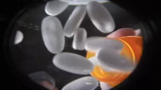 Opioids: What you need to know