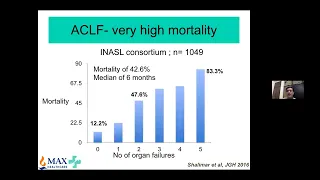 ISG MASTERCLASS I: (16) Stepwise Management of Alcoholic Hepatitis