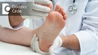 Causes of severe foot pain with normal uric acid - Dr. Mohan M R