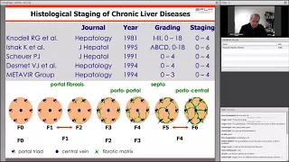 Hepatic fibrosis assessment using multiparametric biomarker tests