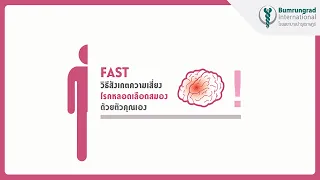 วิธีสังเกตอาการโรคหลอดเลือดสมองเบื้องต้นง่ายๆ ตามหลัก F.A.S.T. | บำรุงราษฎร์