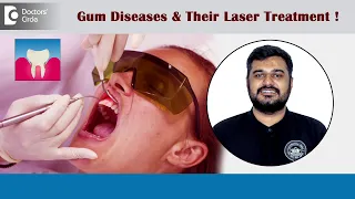 LASER Treatment for Bleeding Gums, Gum Diseases & Gum Pockets - Dr.Parikshith H M | Doctors’ Circle