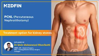 PCNL (Percutaneous Nephrolithotomy) Surgery for Kidney Stones Explained