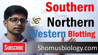 Difference between Southern and northern blotting and western blotting