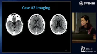 Update in Stroke 2019 - Emily Ho, MD, PhD