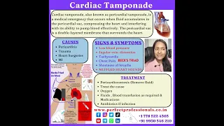 Cardiac Tamponade #nclex #nursingexam #nursingincanada #nclextips #nclexstudyguide#nclexprep#nurses