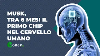 ELON MUSK, tra sei mesi il primo chip nel cervello umano