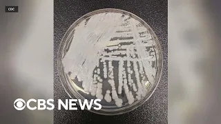 CDC issues warning about a fungus called Candida auris