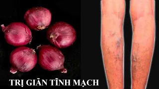 TRỊ DỨT ĐIỂM SUY GIÃN TĨNH MẠCH, HUYẾT ÁP CAO - Verabschieden Sie sich für immer von Krampfadern