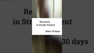 Recovery In stroke Patient| Fast recovery| Best exercises for Stroke patient