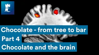 Chocolate from tree to bar - Chocolate and the Brain