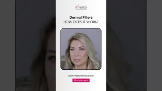 How do dermal fillers work