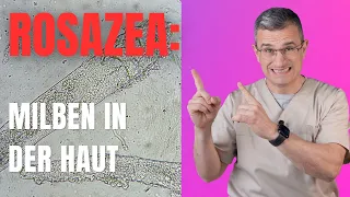 Demodex: Diese Rolle spielt die Haarbalgmilbe bei Rosazea: Dr. Kasten Hautmedizin in Mainz