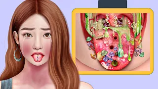ASMR RemoveTongue Piercing & Maggot Infected | Severely Injured Animation