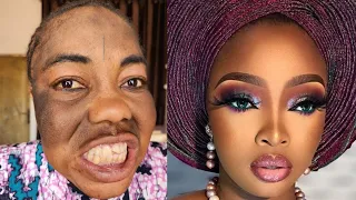 BOMB 💣 MUST WATCH 😱 SHE WAS TRANSFORMED💄BRIDAL GELE AND MAKEUP TRANSFORMATION ✂️ CIRURGIA PLASTICA 💉