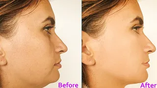 Effective Exercises to Slim Down Face & Double Chin | Dr Alan Mandell, DC