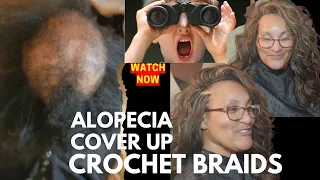 Alopecia Cover up Crochet Braids Install• 👀 look and learn #crochetbraids #braidstyles #crochetstyle