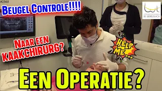 BEUGEL controle bij de ORTHODONTIST. Moet ik een OPERATIE ondergaan bij een KAAKCHIRURG? #2868