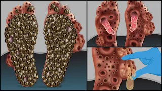 ASMR Treatment Animation of Dogticks | severely Injured Animation | Universe 팅거 ASMR