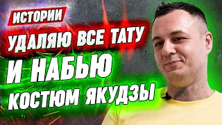 Все спрашивали, зачем мне НОСКИ? | Тату-мастер пришёл на лазерное удаление татуировки