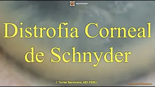 Distrofia Corneal de Schnyder.