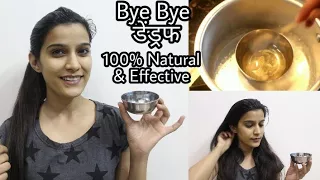 How To : Remove Dandruff Permanently | Result in 1st wash | 100% Natural & Effective