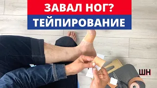 Зажатые пальцы? Как освободить пальцы? Тейпирование стоп при завалах внутрь? | Школа Ног