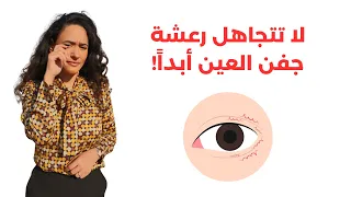 رعشة الجفن التي تحدث فجأة / علاجها / لا تتجاهلها لهذه الأسباب