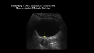 Renal US talk