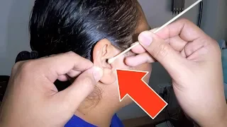 Foreign Body Stuck in Woman's Ear Canal - So Itchy!