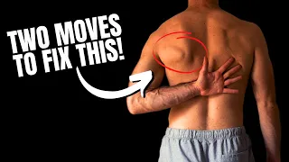 Fix Scapular Winging In 10 Minutes (Real Results)