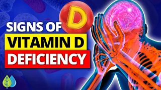 ✨Top 13 Vitamin D Deficiency Symptoms You NEED to Know // Signs of Vitamin D Deficiency