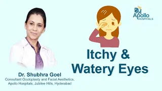How to treat Itchy & Watery Eyes | Dr. Shubra Goel, Consultant Oculoplastic & Facial Aesthetics