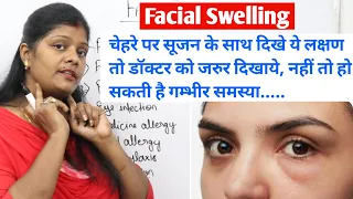 चेहरे पर सूजन होने के क्या कारण है | किस बीमारी का लक्षण है | What is cause of face swelling inhindi