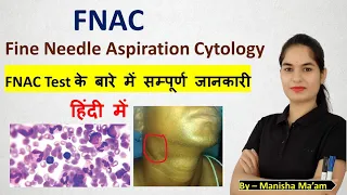Fine Needle Aspiration Cytology | FNAC Test in hindi | FNAC test kya hota hai | FNAC test procedure