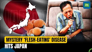 Japan’s Mystery Flesh-Eating Disease: Is It The Return Of Covid Like Era For The Country?