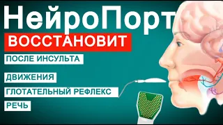 НЕЙРОПОРТ ВОССТАНОВИТ ПОСЛЕ ИНСУЛЬТА движения, глотание, равновесие, речь.