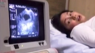 Robin Padilla says goodbye to Baby Cutie Pie VIDEO Mariel Rodriguez Miscarriage