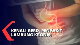 Penyakit Asam Lambung atau Gerd Meningkat di Indonesia, Apakah Kamu Salah Satunya?