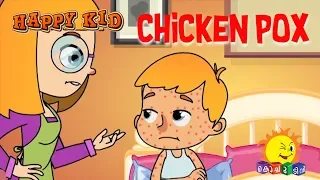 Happy Kid | Chicken Pox | Episode 41 | Kochu TV | Malayalam