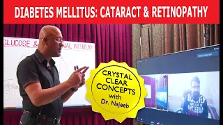 Diabetes Mellitus | Cataract & Retinopathy | LIVE Q&A