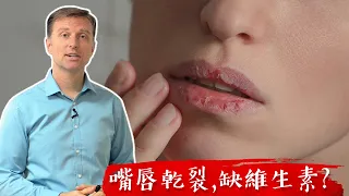 嘴唇乾裂,缺什麼維生素? 自然療法, 柏格醫生 Dr Berg