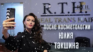 Юлия Такшина после процедуры биоревитализации для увлажнения кожи #КорочеОКрасоте