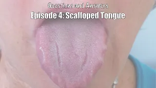 Question 4: What Causes Tongue Scalloping?