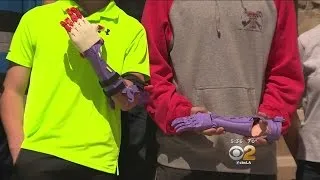 High School Students Create Prosthetic Left Hand For Teen