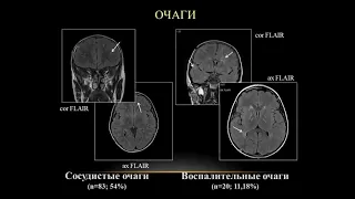 7) МР-картина перинатальной ВИЧ-инфекции в эпоху антиретровирусной терапии