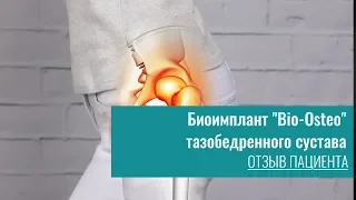 Биоимплант "Bio-Osteo"  тазобедренного сустава  отзывы пациентов