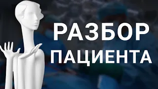 Разбор пациента. Фото до и после, компьютерная томограмма, как проводится ортогнатическая операция