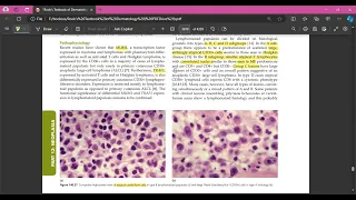 chapter- 140. Cutaneous lymphomas.  part 2 Primary cutaneous cd30+ lymphoproliferative disorders